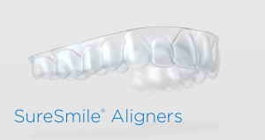 SureSmile Aligners