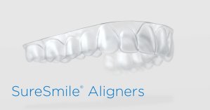 SureSmile Aligners